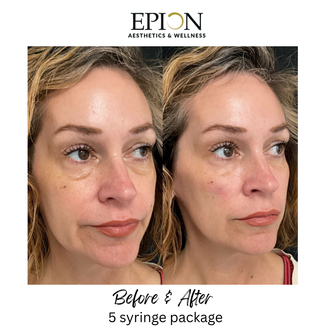 89E591A2-438D-48E3-880A-30FDDD2BC105