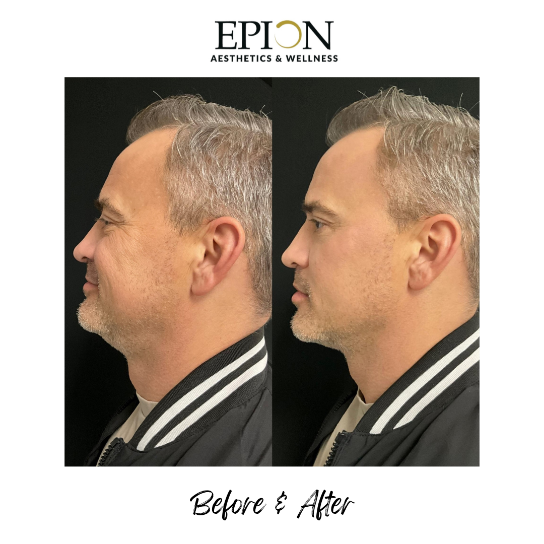 A2DCB3FD-B62A-4144-9C56-674864FDA9D9