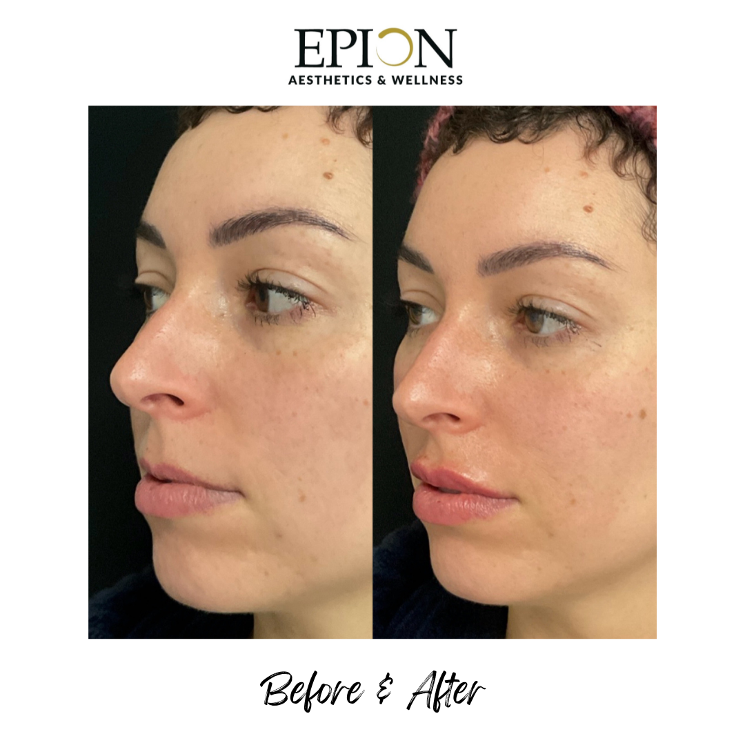 A5CE305C-87BC-4EDA-8FD9-22DC087FC71D