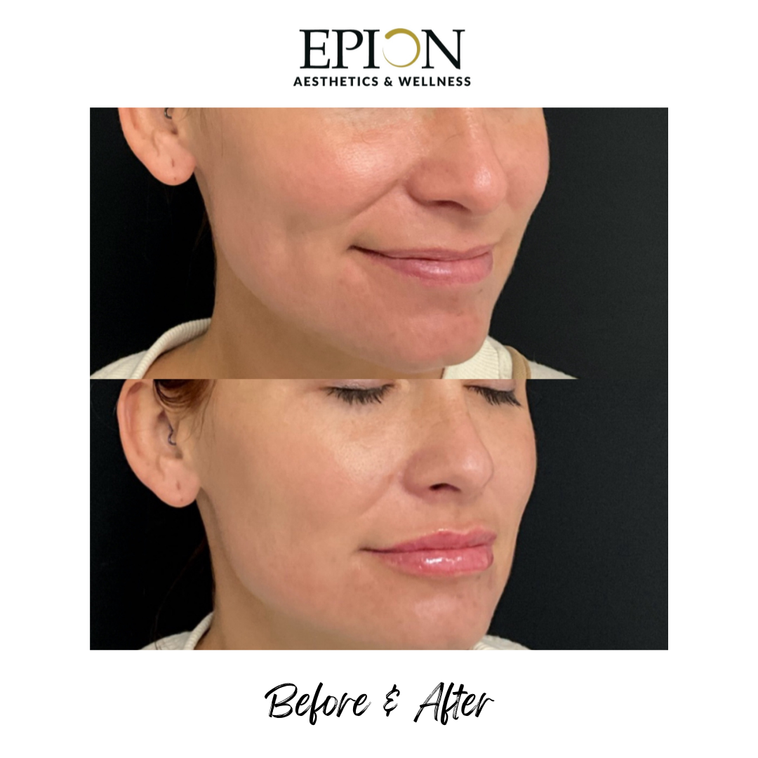 A84868D8-85FD-435D-9665-156C7E79B80B