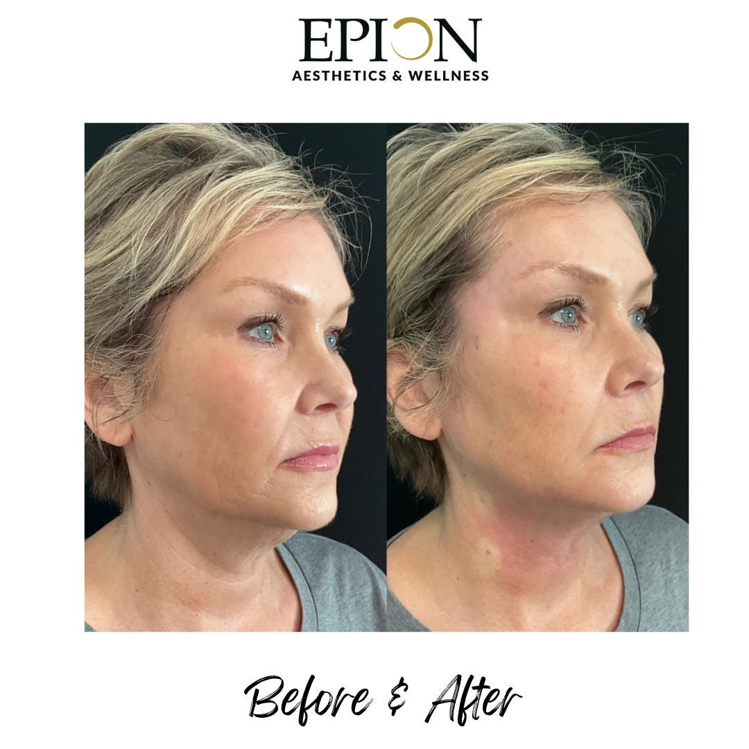 CDD9F949-F672-434C-BC21-F4984ED16697