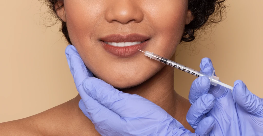 dermal-fillers